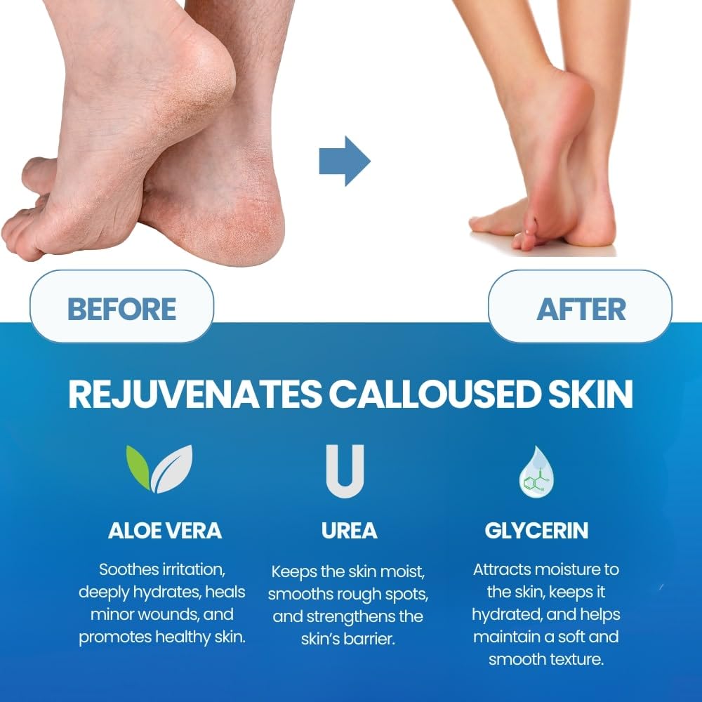 Средство для удаления кутикулы – обзор и цена Foot Mask Peeling