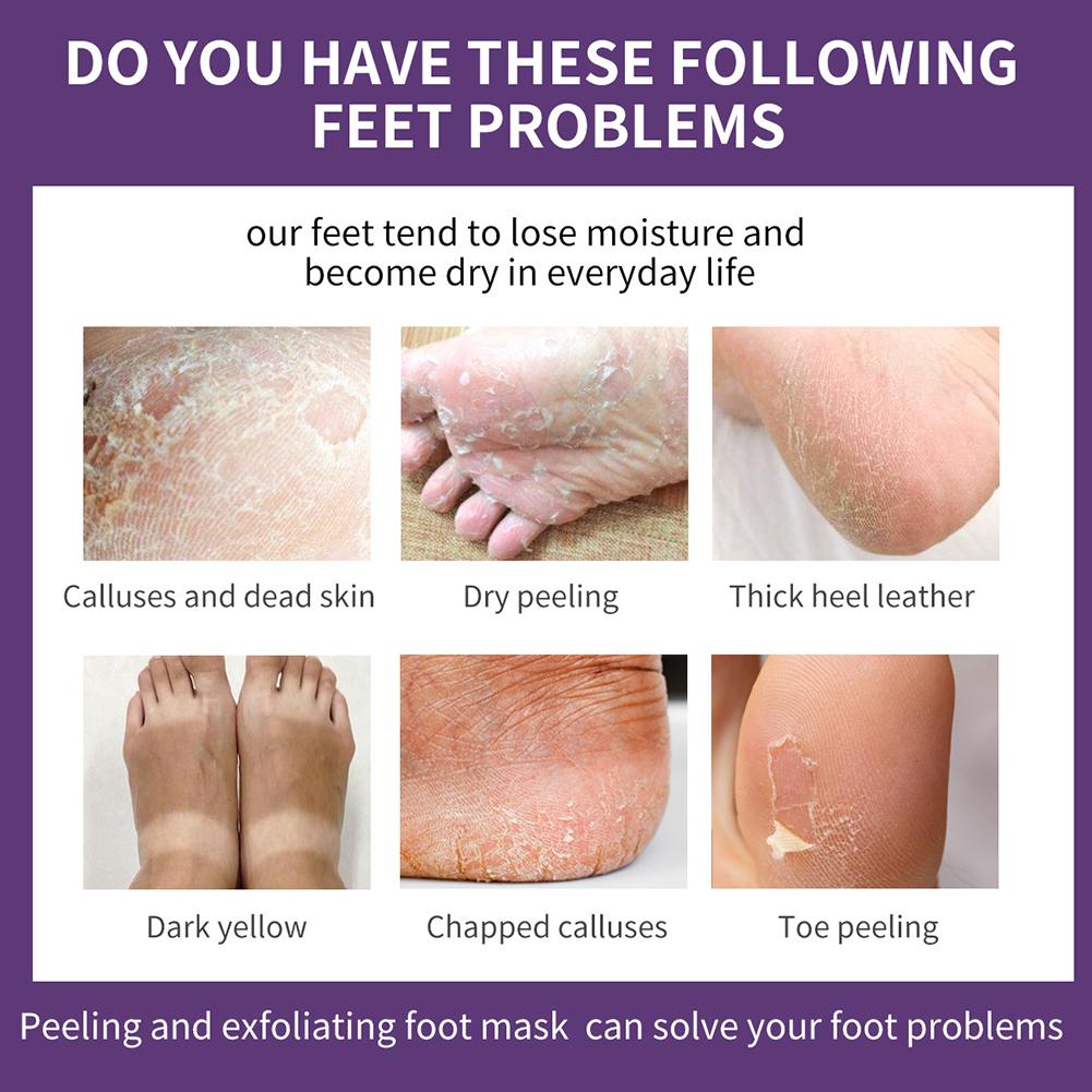 Маска для ног с экстрактом лав – обзор и цена Foot Mask Peeling