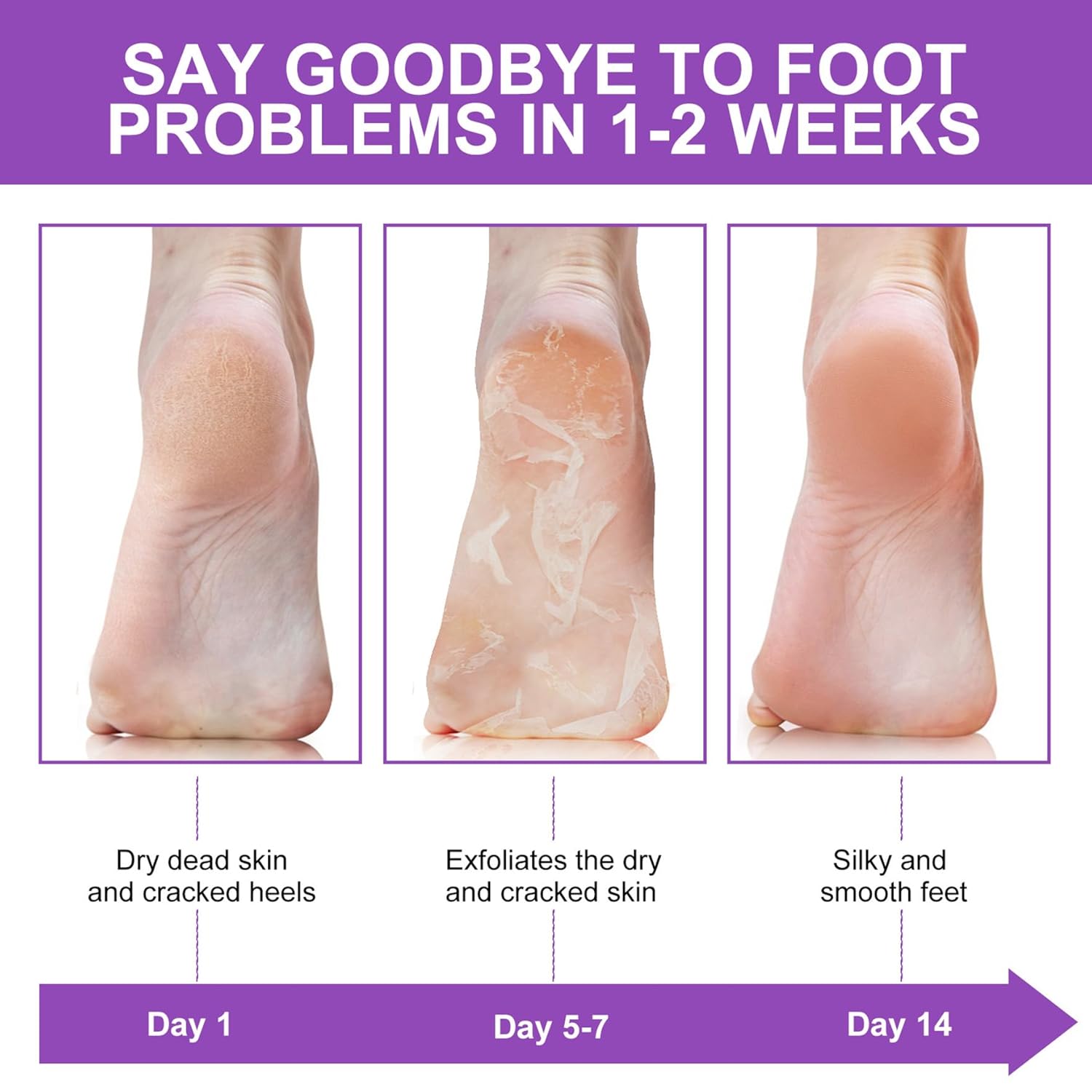 Отшелушивающие носки-маска для – обзор и цена Foot Mask Peeling