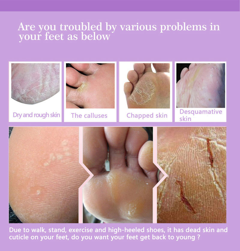 Отшелушивающие маски для ног,  – обзор и цена Foot Mask Peeling