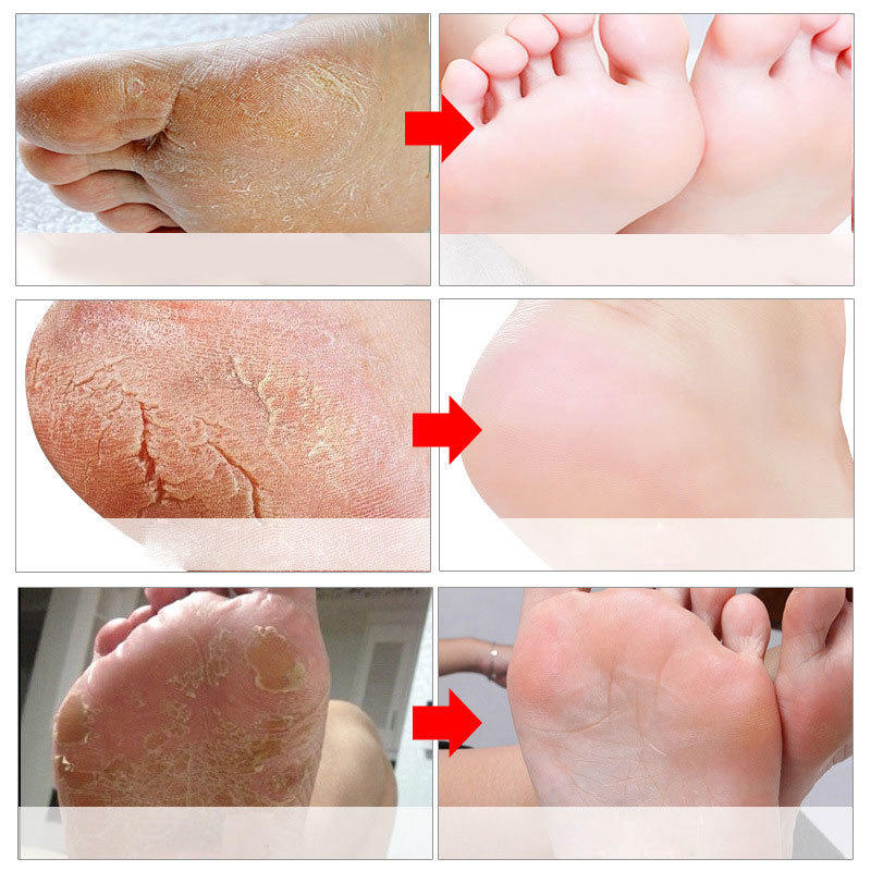 Отшелушивающие маски для ног,  – обзор и цена Foot Mask Peeling