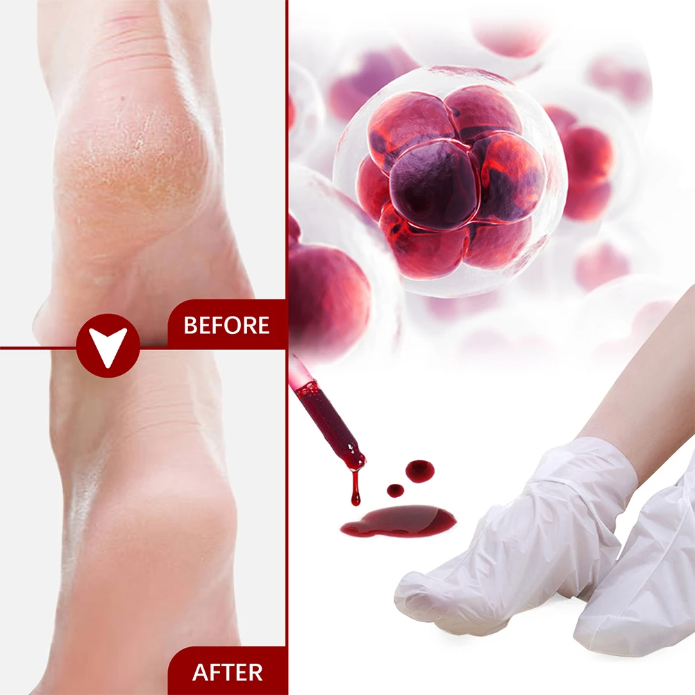 5/2/1 пара масок для ног, фрук – обзор и цена Foot Mask Peeling